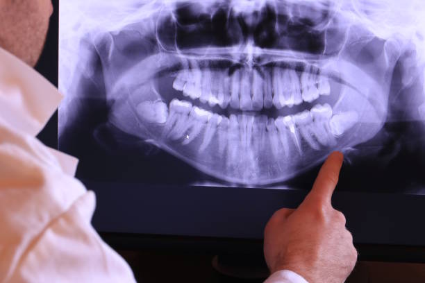 Best Emergency Dental Services for Seniors in Fanwood, NJ