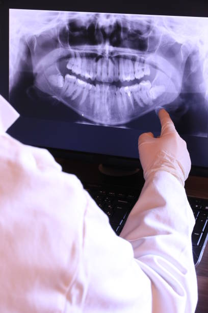 Best Emergency Root Canal Treatment in Fanwood, NJ
